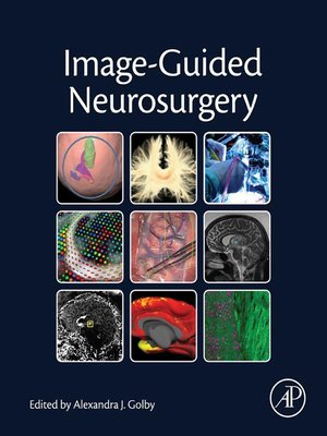cover image of Image-Guided Neurosurgery